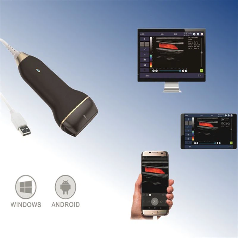 Handheld Color Doppler