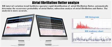 Holter-seurannan analyysijärjestelmät